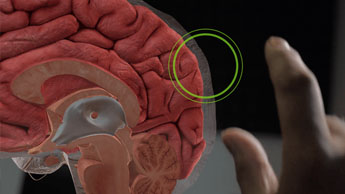 brain showing migraine spot